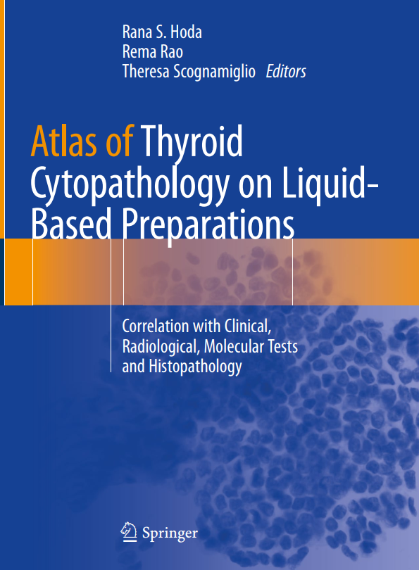 Atlas of Thyroid Cytopathology on Liquid Based Preparations Correlation