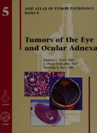 Tumors of the eye and ocular adnexa